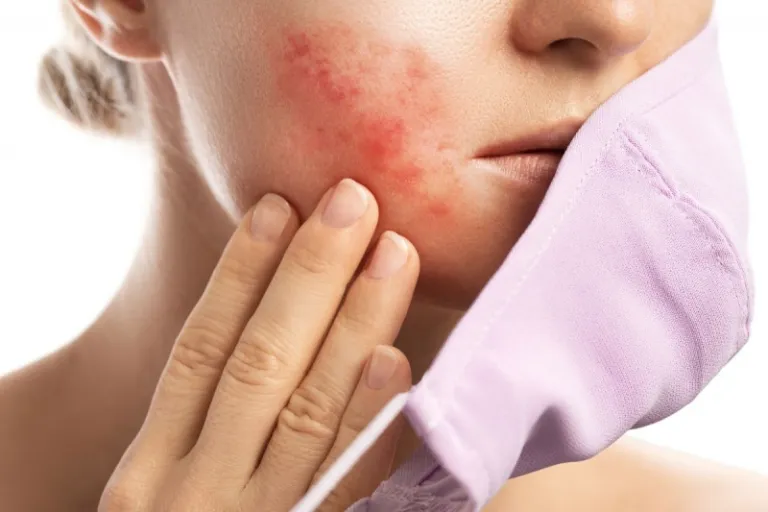 travel skin breakout